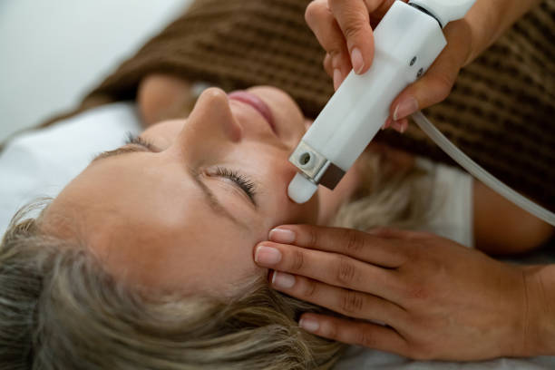 Laser Treatments